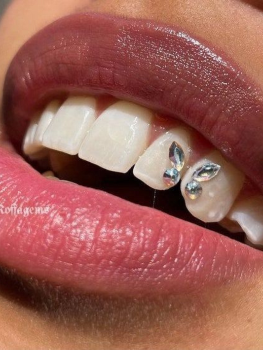 Teeth Gems and Whitening